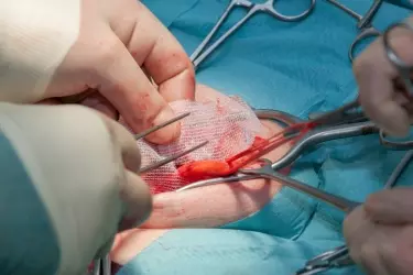 best hospital for hernia repair surgery in Purnia, best doctor for hernia treatment in Purnia, cost of hernia surgery in Purnia